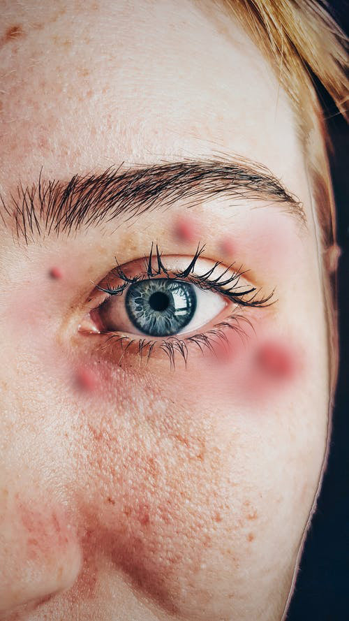 "When NOT to Lash: Recognizing Health and Medical Red Flags"